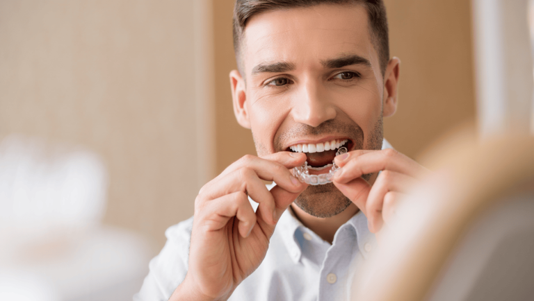 Clear Aligner Therapy – co jsou zarovnávače, jsou účinné zarovnávače Invisalign