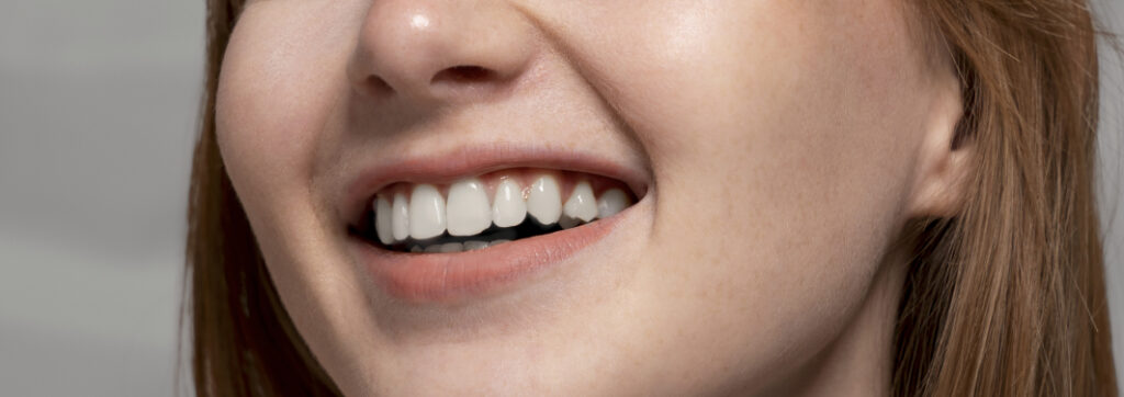 Professional teeth cleaning: why is it necessary, even if you clean everything correctly?