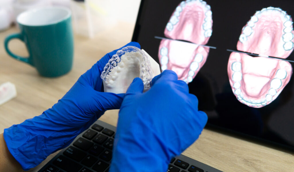 Co je digitální stomatologie – Kompletní průvodce