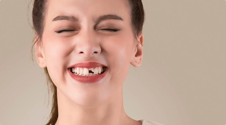 Treatment of dental injuries