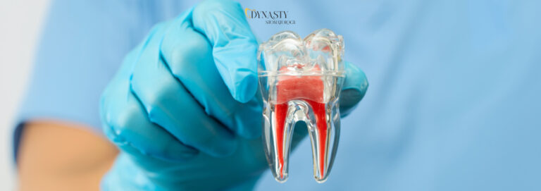 Opakovaná endodontická léčba – proč je někdy nutné opakované ošetření kořenových kanálků