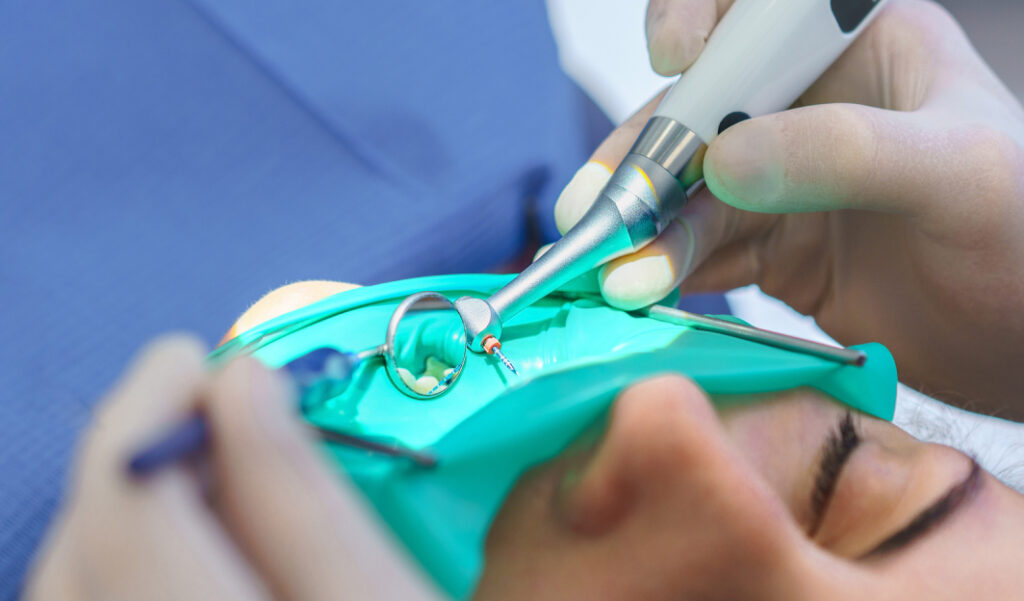 Opakovaná endodontická léčba – proč je někdy nutné opakované ošetření kořenových kanálků